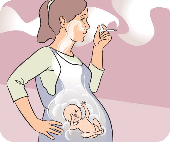 اضرار التدخين على الحامل