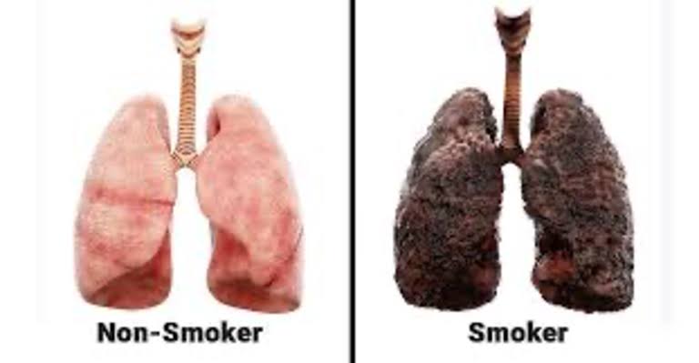 التدخين والجهاز التنفسي