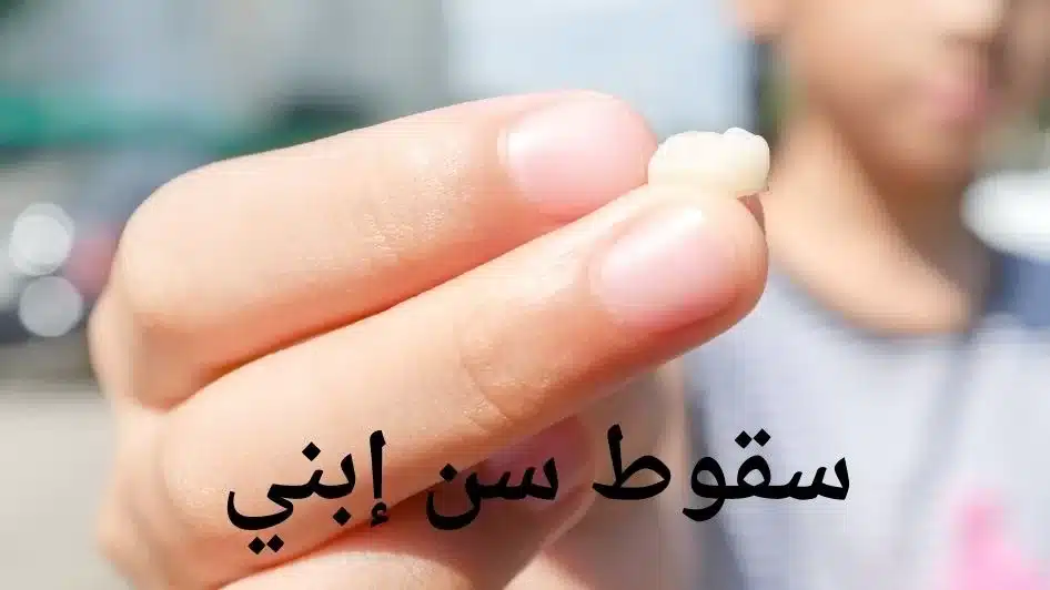تفسير حلم سقوط السن الامامي في اليد او علي الارض 4 سقوط سن إبني jpg